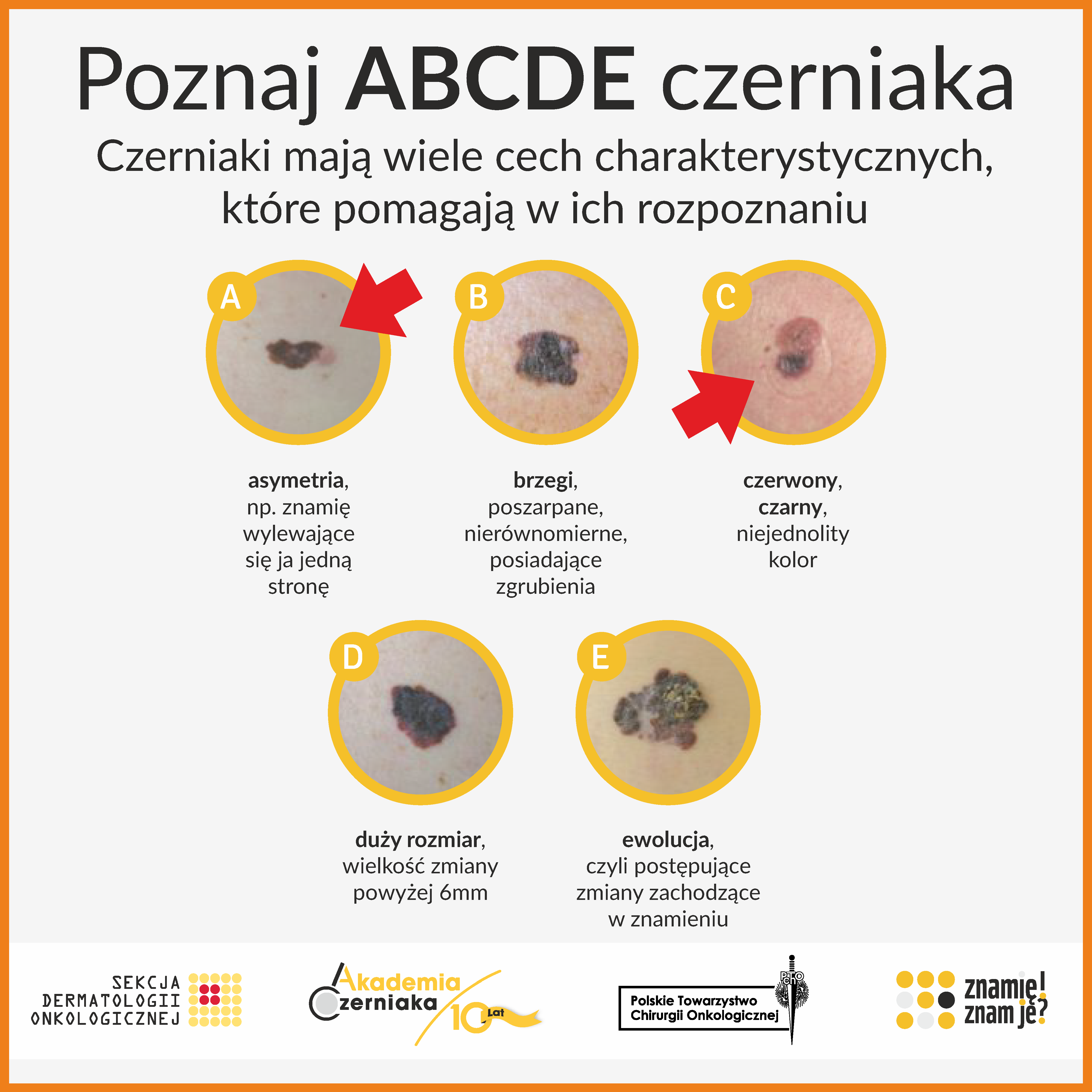 Program profilaktyki czerniaka w edycji 2020/2021